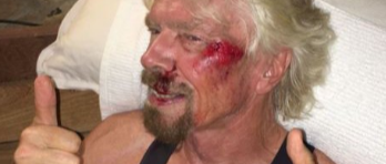 Richard Branson Bike Accident