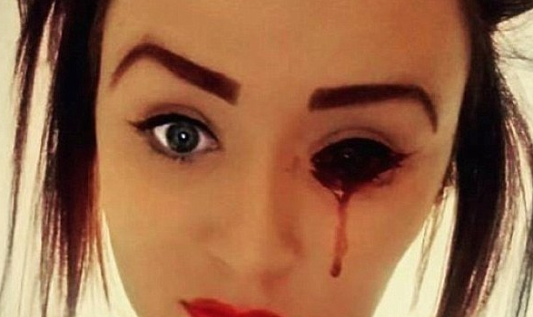 Teen Bleeds From Eye