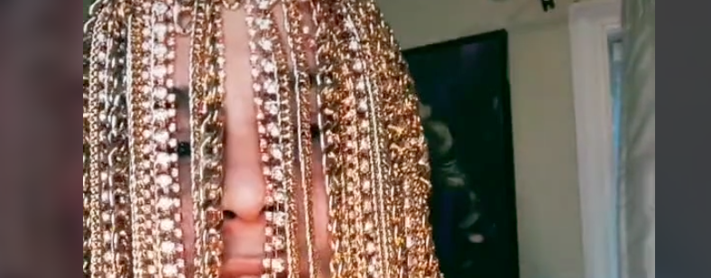 Rapper Gets Gold Chain Implants