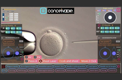 IVF Robot Screen