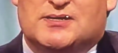 Ted Cruz Lip Debris