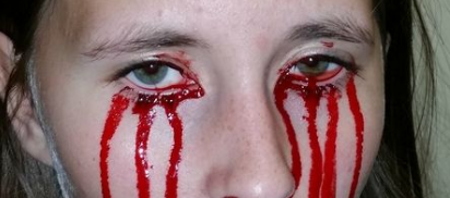 Woman Bleeds From Eyes