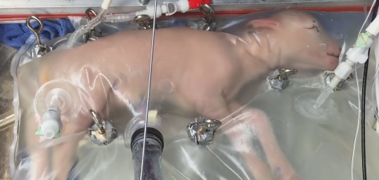 Artificial Womb