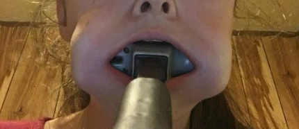 Hammer Stuck In Mouth