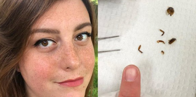 Woman Has Cockroach Crawl In Ear