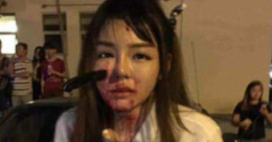 Girl Stabbed in Face