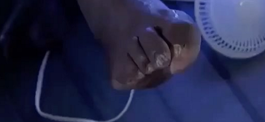 Shaq Toes