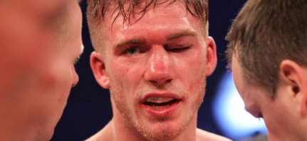 Nick Blackwell Injured